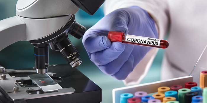 Coronavirus Blood Sample Mi