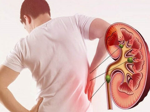 چند توصیه غذایی برای پیشگیری از سنگ کلیه 2 کلیه