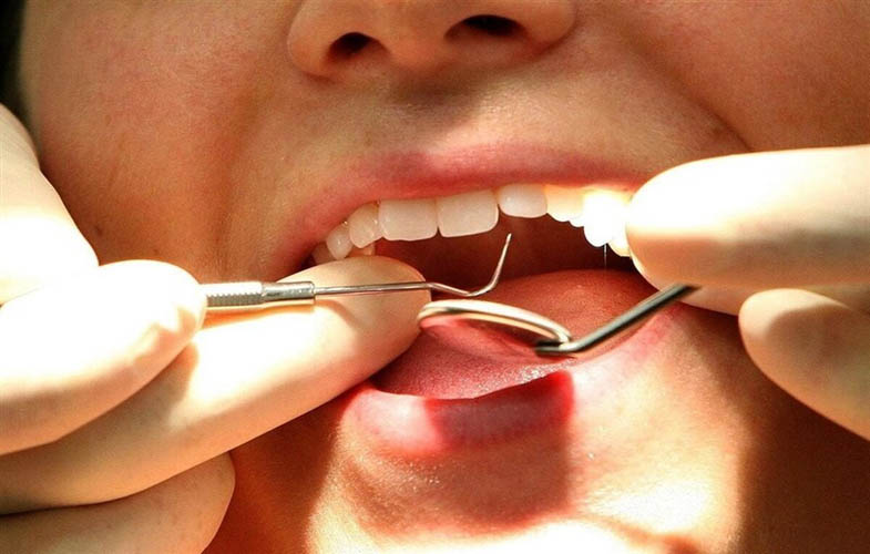 توقف خونریزی و بازسازی استخوان با فناوری نانو در دندانپزشکی 1 650745 399